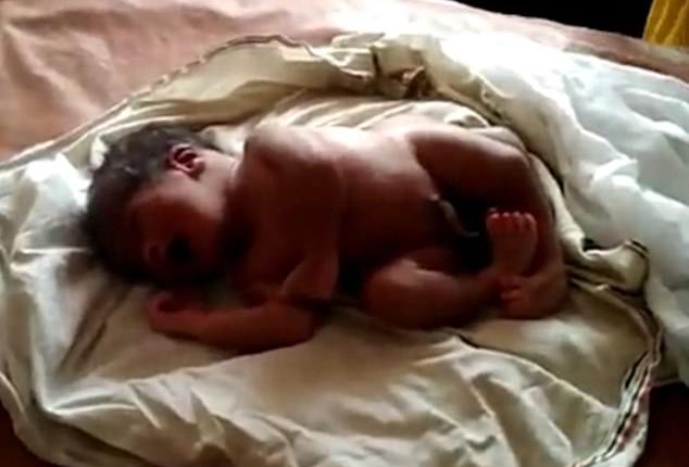 یک معجزه واقعی، تولد نوزادی با 4 پا