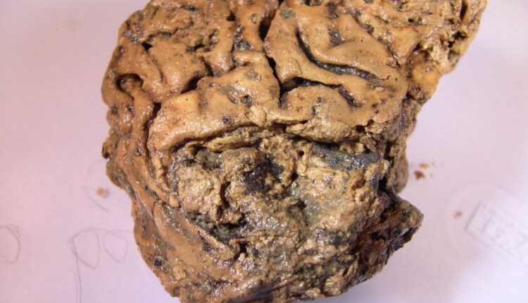 مغز باستانی با قدمت 2600 سال که بصورت سالم حفظ شده است