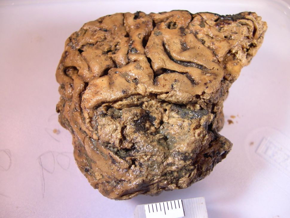 مغز باستانی با قدمت 2600 سال که بصورت سالم حفظ شده است
