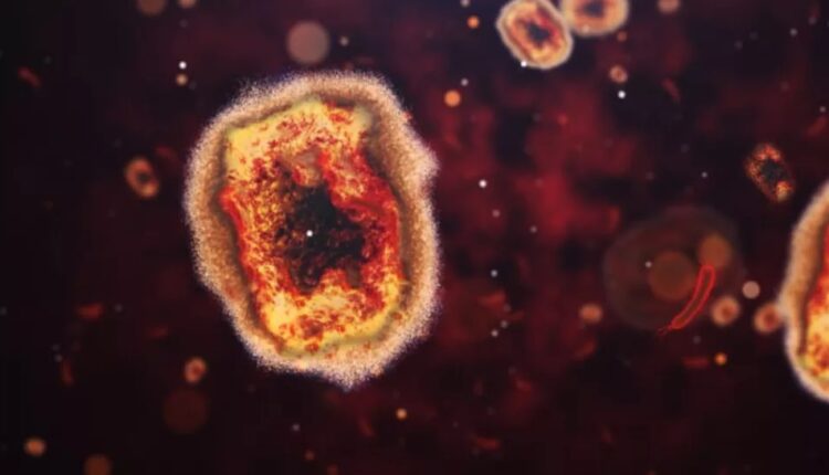 آبله میمون چیست