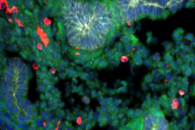 ساخت ریه با سلول بنیادی موش